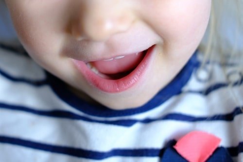 Baby Mouth | Best Pediatric Dentist | Tiffin OH 44883 | Fluoride, Crowns, Emergency Dentist, Fillings for Kids, Tooth Extractions